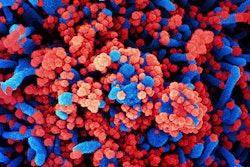 2021 04 28 23 59 2806 Sars Co V 2 Particles Sem Niaid 400