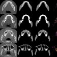 2021 04 29 16 29 3381 2021 03 30 Jdr 03 30 Cbct Deep Learning Figure 400