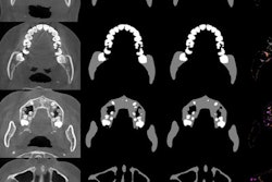 2021 04 29 16 29 3381 2021 03 30 Jdr 03 30 Cbct Deep Learning Figure 400