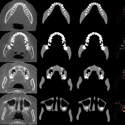 2021 04 29 16 29 3381 2021 03 30 Jdr 03 30 Cbct Deep Learning Figure 400