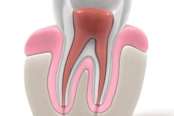 2017 01 25 17 32 55 822 Endodontics Root Canal 400