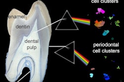 2021 05 03 22 04 2400 2021 05 03 Tooth Composition 400