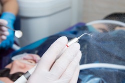 2021 05 06 21 37 3247 Dental Ultrasonic Scaler 400