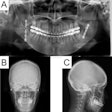 2021 05 11 22 22 1225 2021 05 12 Jaw Surgery3 Lg 20210511221750