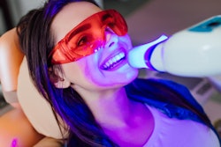 2021 05 13 22 04 7087 Teeth Whitening Woman 400