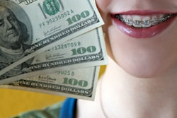2021 05 20 18 53 4521 Braces Money 400