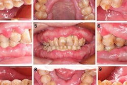 2021 06 01 20 31 1319 2021 06 02 Top Ig G4 Perio2 20210601205653