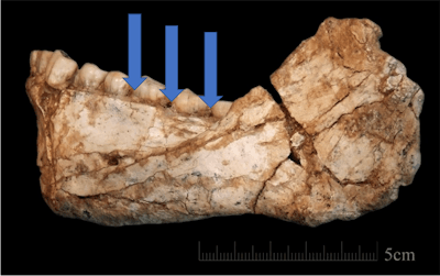 Photo credit: Jean-Jacques Hublin, MPI EVA Leipzig. Arrows added by Dr. Alvin Danenberg.