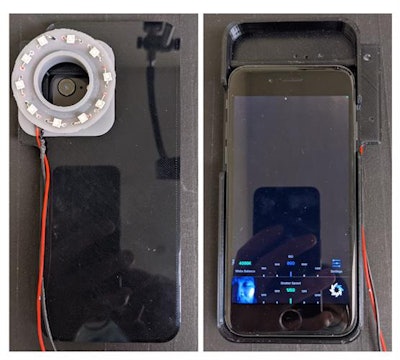 A smartphone's camera was augmented to capture LED-illuminated images. All images courtesy of Ruikang Wang, PhD.