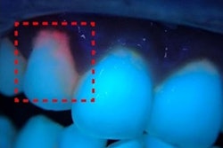 2021 06 28 19 29 1212 2021 06 29 Smartphone Bacteria2 400