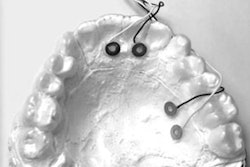 2021 07 06 22 18 5059 2021 07 06 Jaw Pacemaker 400