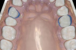 2021 07 08 20 40 1943 2021 07 09 Baby Tooth Technique1 B Large 20210708205116