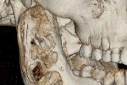 2021 07 13 19 54 1219 2021 07 15 Insider Jaw Tumor3 20210713193907
