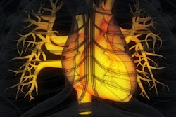 2021 07 16 20 10 0766 Heart Yellow 400