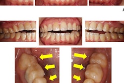 2021 08 06 22 06 0647 2021 08 09 Pbs3 Lg 400