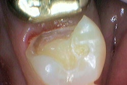 2021 08 12 15 42 2150 2021 08 12 Case Image 3 400thumb