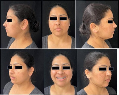 Images of patient three months after surgery.