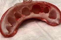 2021 08 20 14 50 1788 2021 08 Fangs Thermoplastic1 400