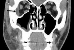 2021 08 23 19 00 9221 2021 08 24 Abscess2 400