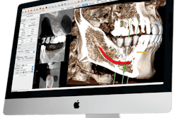 2021 08 25 16 06 5860 2021 08 25 Osteoid Invivo 6 20210825162435