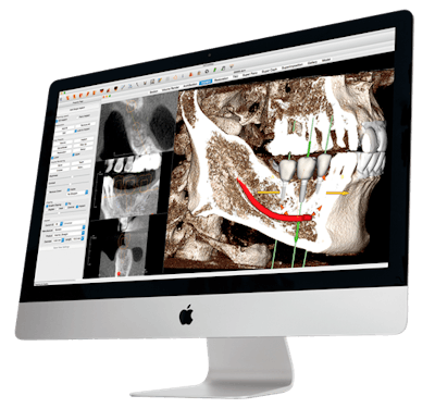 The Invivo6 3D dental imaging software. Image courtesy of Osteoid.
