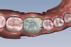 2021 08 31 14 17 0237 2021 08 31 Glidewell Ai Crown 400