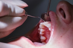 2020 02 07 23 18 9099 Dental Patient Periodontal Exam 400