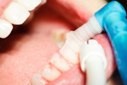 2021 09 03 21 02 5891 Dental Polishing 400