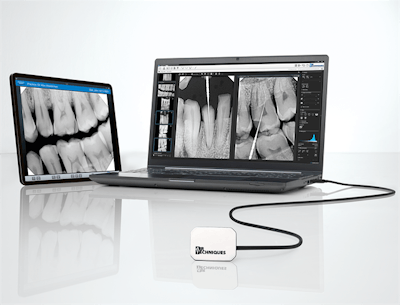 The SensorX intraoral sensor. Image courtesy of Air Techniques.