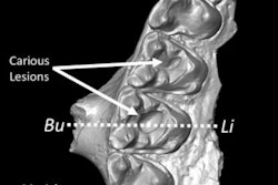 2021 09 16 17 09 6198 2021 09 Mammal Caries1 Thumb