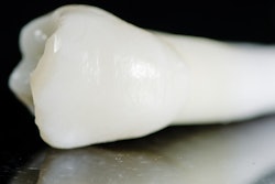 2021 09 23 16 05 4199 Tooth Maxillary Premolar 400