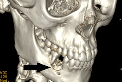 2021 10 01 22 23 8198 2021 10 04 Granuloma3 20211001224556