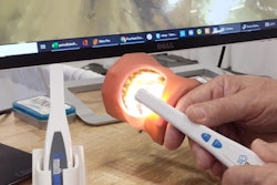 2021 10 13 15 47 9325 2021 10 13 Mouth Watch Plus Demo 400