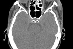 2021 10 21 21 39 9312 2021 10 Blindness1 Thumb