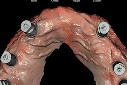 2021 10 26 16 34 7691 2021 10 29 Carestream Cs3800 20211026162633