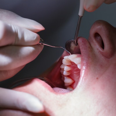 2020 02 07 23 18 9099 Dental Patient Periodontal Exam 400