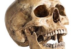 2020 03 31 21 15 8517 Skull Mouth 400