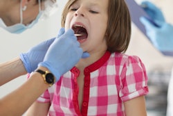 2021 11 04 22 24 4442 Throat Tonsil Child 400