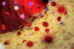 2021 11 30 15 59 6292 Plaque Artery 400