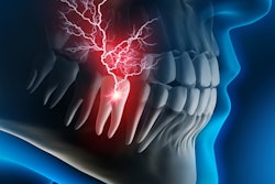 2020 02 18 23 17 2219 Tooth Pain 400