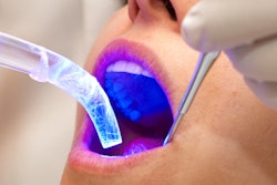 2020 07 23 20 23 7535 Dental Work Light 400