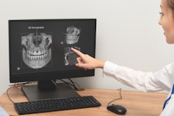 2022 01 07 23 56 2460 Dental Imaging Tomography 400
