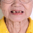 2022 01 24 02 31 5475 Missing Teeth Woman 400