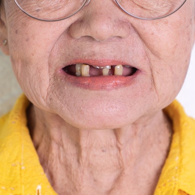 2022 01 24 02 31 5475 Missing Teeth Woman 400