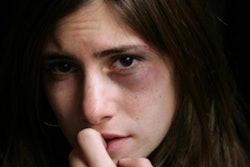 2019 05 01 18 27 5102 Domestic Violence Abuse 400