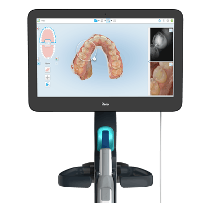 The iTero Element 5D Plus imaging system. Image courtesy of Align.