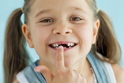 2021 02 25 19 13 0555 Girl Missing Tooth 400