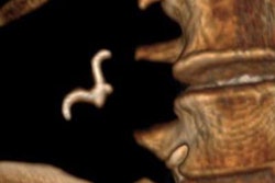 2022 02 01 03 56 4101 2022 02 01 Ingested Dentures2 20220201035114