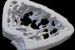 2022 02 02 20 54 7141 2022 02 02 Bone 3 D Model 250