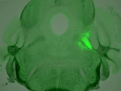 A cluster of neurons with highly active opioid receptors, highlighted in neon green, is located in a small area of the mouse brainstem. Salk Institute, CC BY-NC-ND
